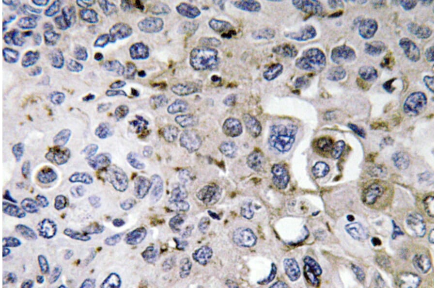 Immunohistochemistry - Anti-PDGF-A Antibody (R12-2297) - Antibodies.com