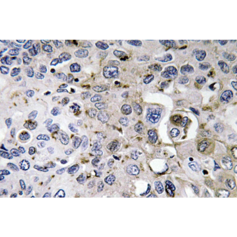 Immunohistochemistry - Anti-PDGF-A Antibody (R12-2297) - Antibodies.com