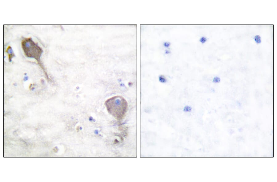 Immunohistochemistry - Anti-Parkin Antibody (C0294) - Antibodies.com
