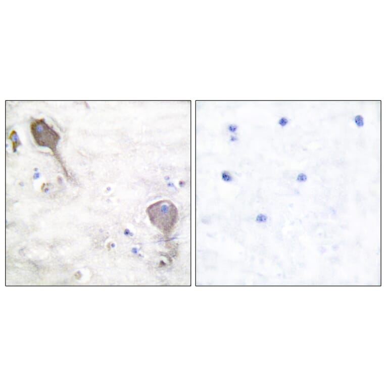 Immunohistochemistry - Anti-Parkin Antibody (C0294) - Antibodies.com