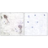 Immunohistochemistry - Anti-Parkin Antibody (C0294) - Antibodies.com