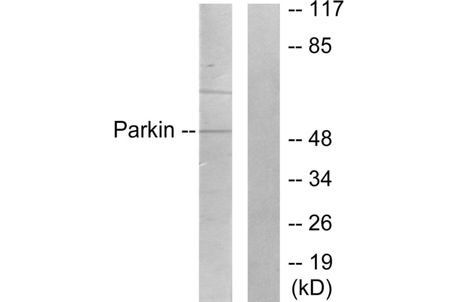 Western Blot - Anti-Parkin Antibody (C0294) - Antibodies.com