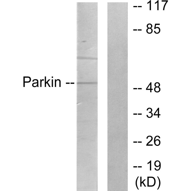 Western Blot - Anti-Parkin Antibody (C0294) - Antibodies.com