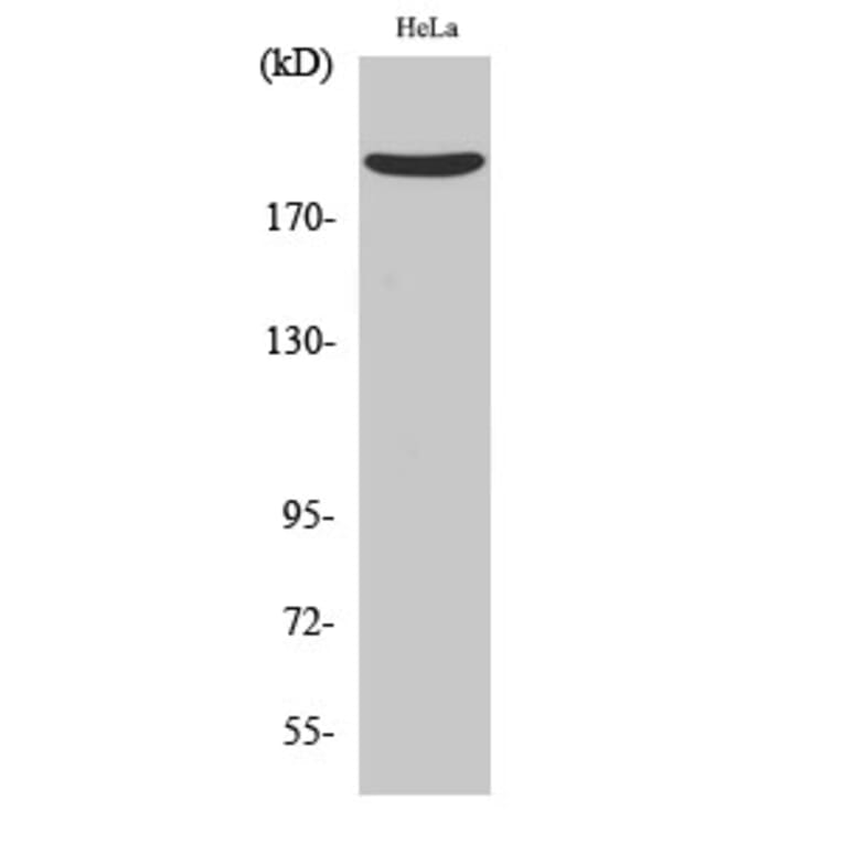 Western Blot - Anti-Nogo A Antibody (R12-2270) - Antibodies.com