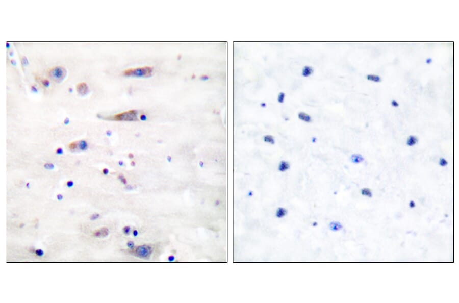 Immunohistochemistry - Anti-NMDAR1 Antibody (B7174) - Antibodies.com