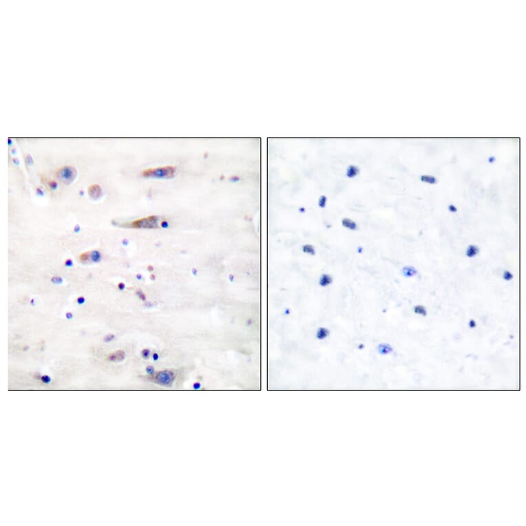 Immunohistochemistry - Anti-NMDAR1 Antibody (B7174) - Antibodies.com