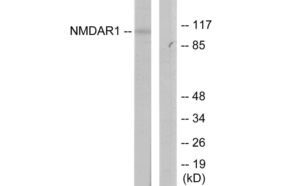 Western Blot - Anti-NMDAR1 Antibody (B7174) - Antibodies.com