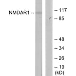 Western Blot - Anti-NMDAR1 Antibody (B7174) - Antibodies.com