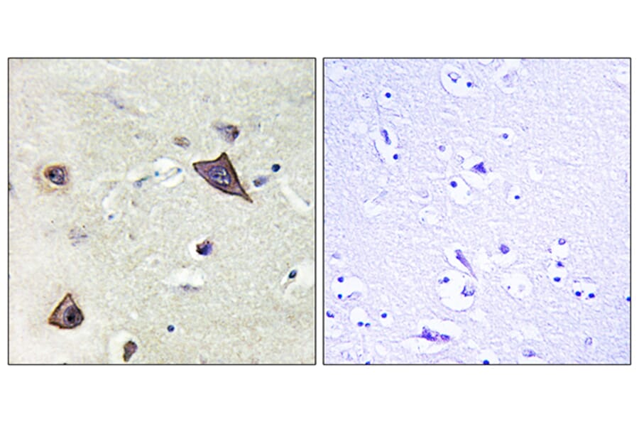 Immunohistochemistry - Anti-NMDAR1 Antibody (B0693) - Antibodies.com