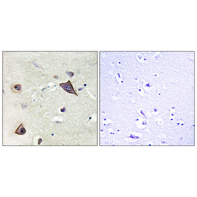 Immunohistochemistry - Anti-NMDAR1 Antibody (B0693) - Antibodies.com