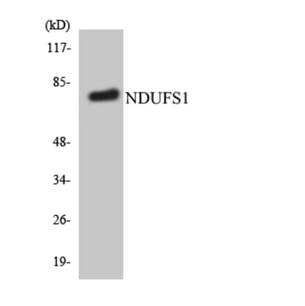 Western Blot - Anti-NDUFS1 Antibody (R12-3084) - Antibodies.com