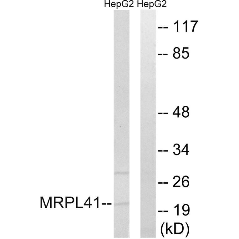 Western Blot - Anti-MRPL41 Antibody (C14078) - Antibodies.com