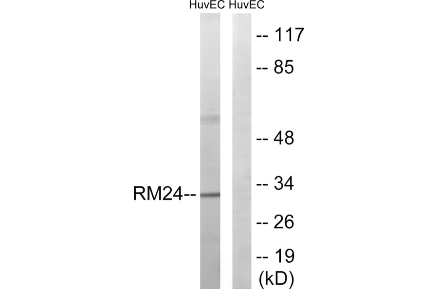 Western Blot - Anti-MRPL24 Antibody (C14068) - Antibodies.com