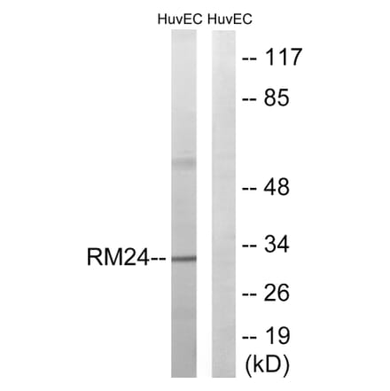 Western Blot - Anti-MRPL24 Antibody (C14068) - Antibodies.com