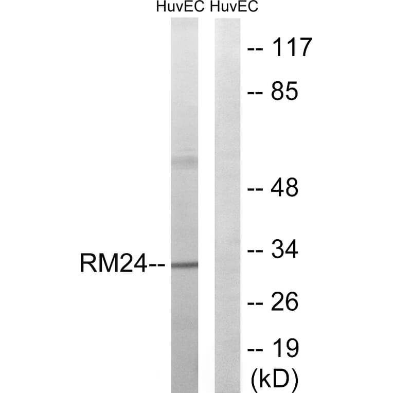 Western Blot - Anti-MRPL24 Antibody (C14068) - Antibodies.com