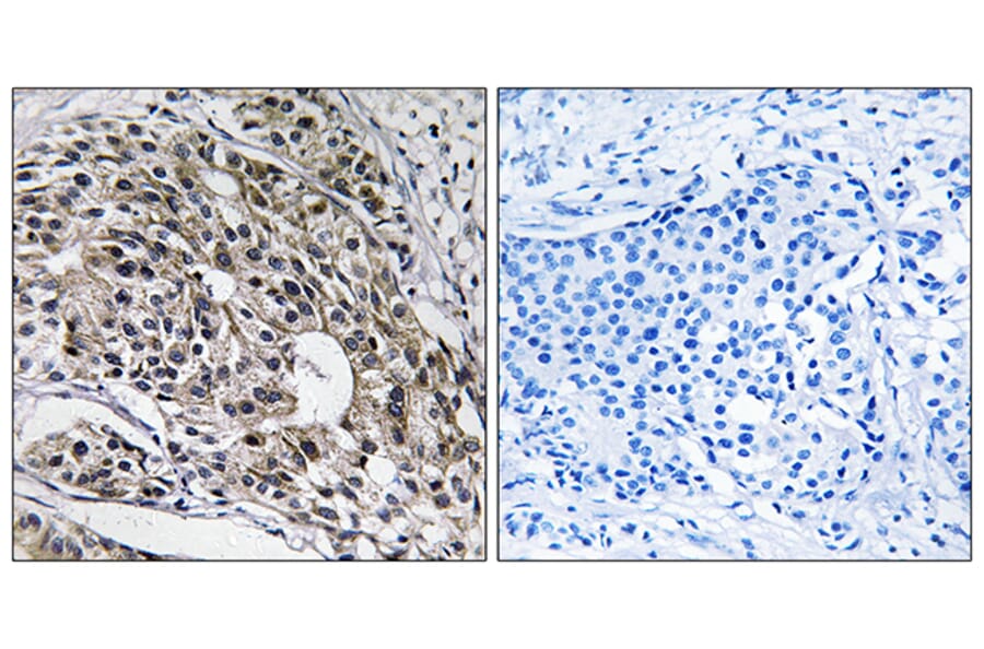 Immunohistochemistry - Anti-MRPL13 Antibody (C14057) - Antibodies.com