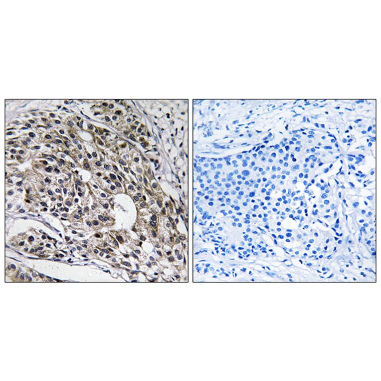 Immunohistochemistry - Anti-MRPL13 Antibody (C14057) - Antibodies.com