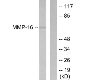 Western Blot - Anti-MMP-16 Antibody (C0268) - Antibodies.com