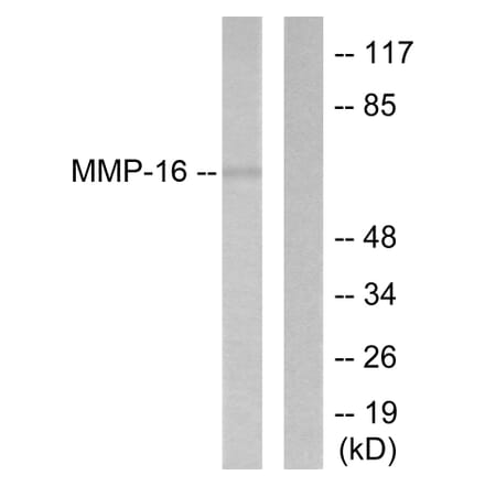 Western Blot - Anti-MMP-16 Antibody (C0268) - Antibodies.com
