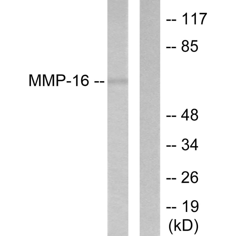 Western Blot - Anti-MMP-16 Antibody (C0268) - Antibodies.com