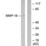 Western Blot - Anti-MMP-16 Antibody (C0268) - Antibodies.com