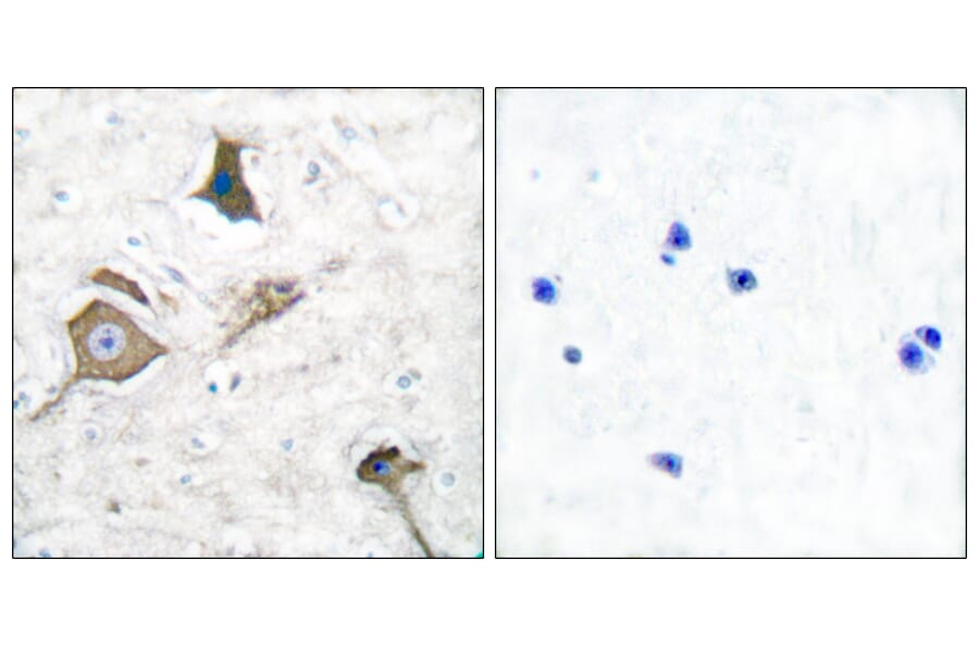 Immunohistochemistry - Anti-MMP-16 Antibody (C0268) - Antibodies.com