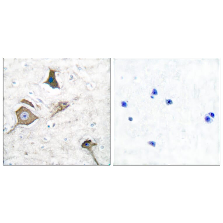 Immunohistochemistry - Anti-MMP-16 Antibody (C0268) - Antibodies.com