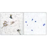 Immunohistochemistry - Anti-MMP-16 Antibody (C0268) - Antibodies.com