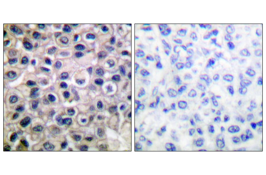 Immunohistochemistry - Anti-MMP-14 Antibody (C0266) - Antibodies.com