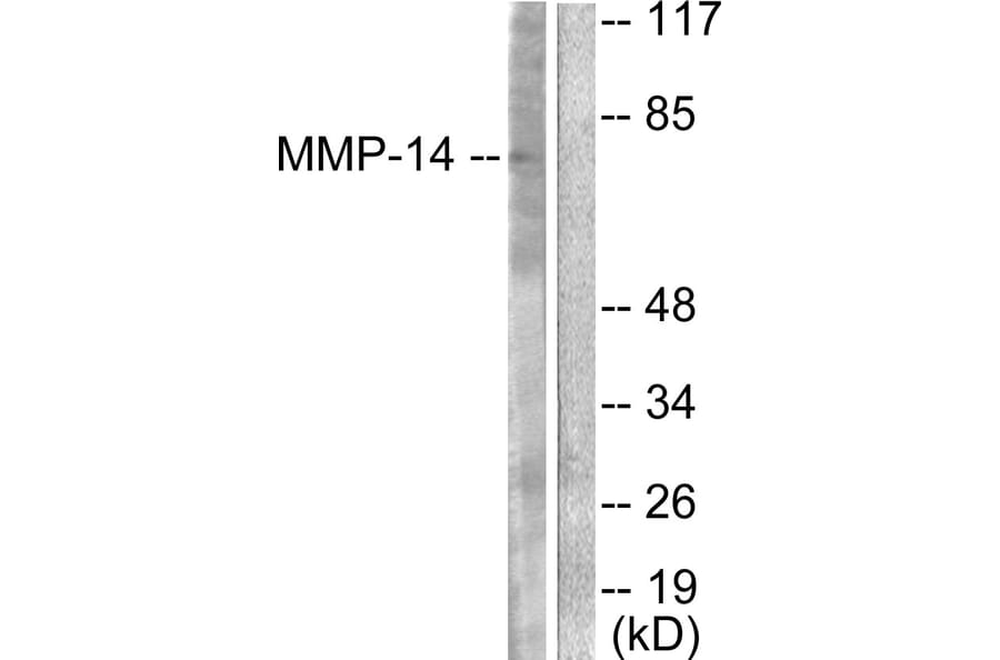 Western Blot - Anti-MMP-14 Antibody (C0266) - Antibodies.com