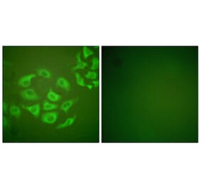 Immunofluorescence - Anti-MMP-10 Antibody (C0263) - Antibodies.com