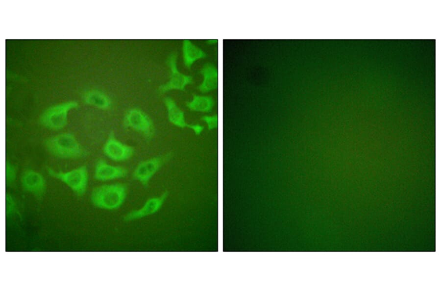 Immunofluorescence - Anti-MMP-10 Antibody (C0263) - Antibodies.com