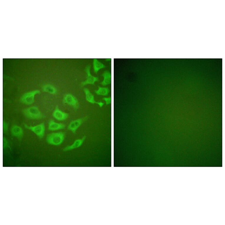 Immunofluorescence - Anti-MMP-10 Antibody (C0263) - Antibodies.com