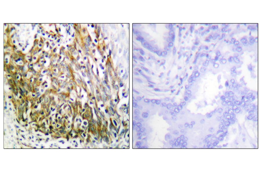 Immunohistochemistry - Anti-MMP-10 Antibody (C0263) - Antibodies.com