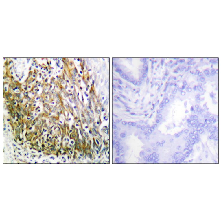 Immunohistochemistry - Anti-MMP-10 Antibody (C0263) - Antibodies.com