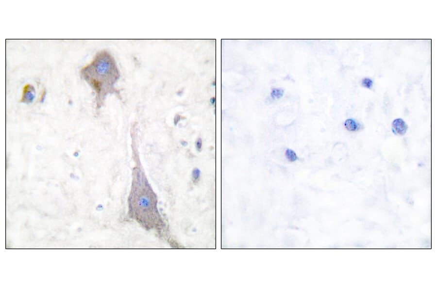 Immunohistochemistry - Anti-mGluR7 Antibody (C0211) - Antibodies.com