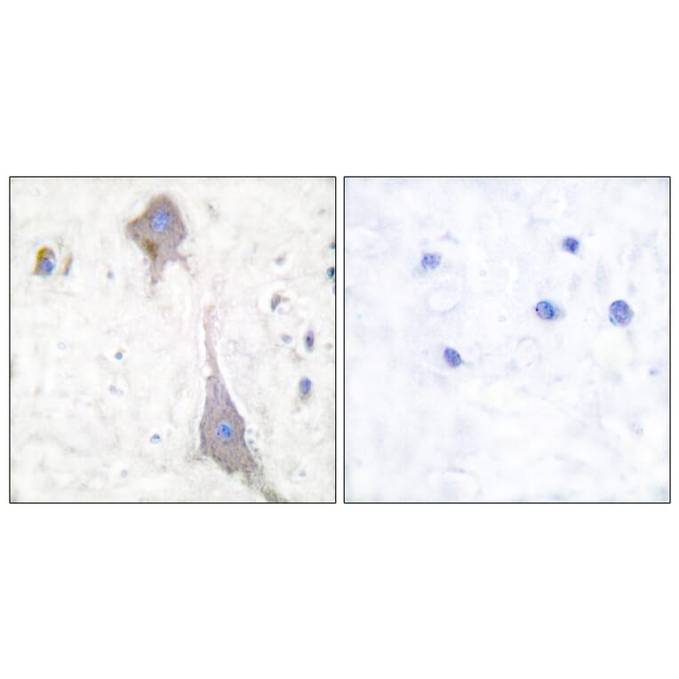 Immunohistochemistry - Anti-mGluR7 Antibody (C0211) - Antibodies.com