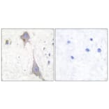 Immunohistochemistry - Anti-mGluR7 Antibody (C0211) - Antibodies.com