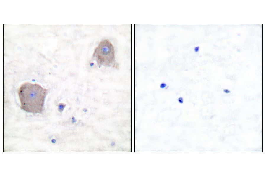 Immunohistochemistry - Anti-mGluR4 Antibody (C0208) - Antibodies.com