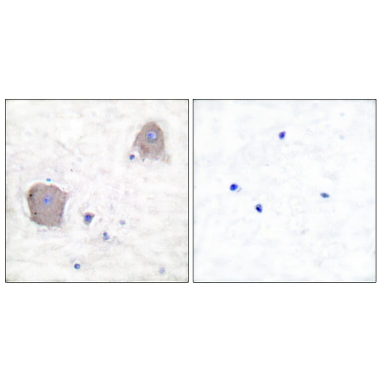 Immunohistochemistry - Anti-mGluR4 Antibody (C0208) - Antibodies.com