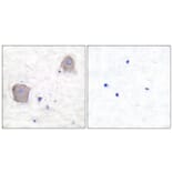 Immunohistochemistry - Anti-mGluR4 Antibody (C0208) - Antibodies.com