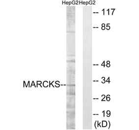 Western Blot - Anti-MARCKS Antibody (B7143) - Antibodies.com
