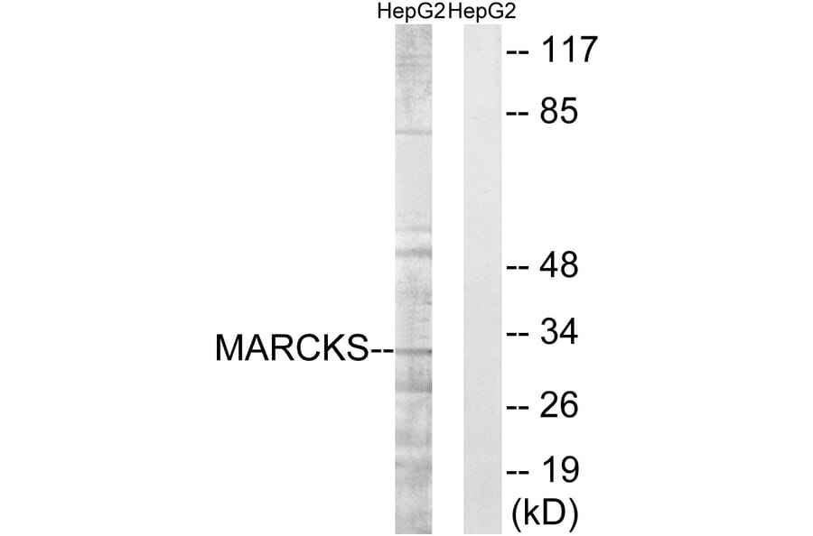 Western Blot - Anti-MARCKS Antibody (B7143) - Antibodies.com