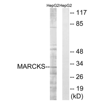 Western Blot - Anti-MARCKS Antibody (B7143) - Antibodies.com
