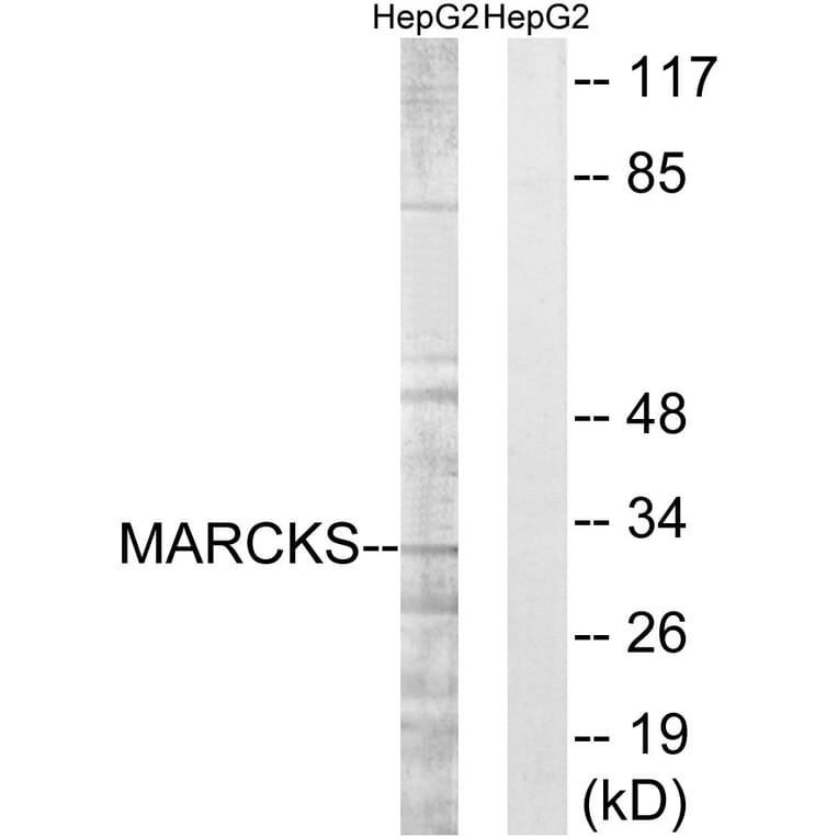 Western Blot - Anti-MARCKS Antibody (B7143) - Antibodies.com