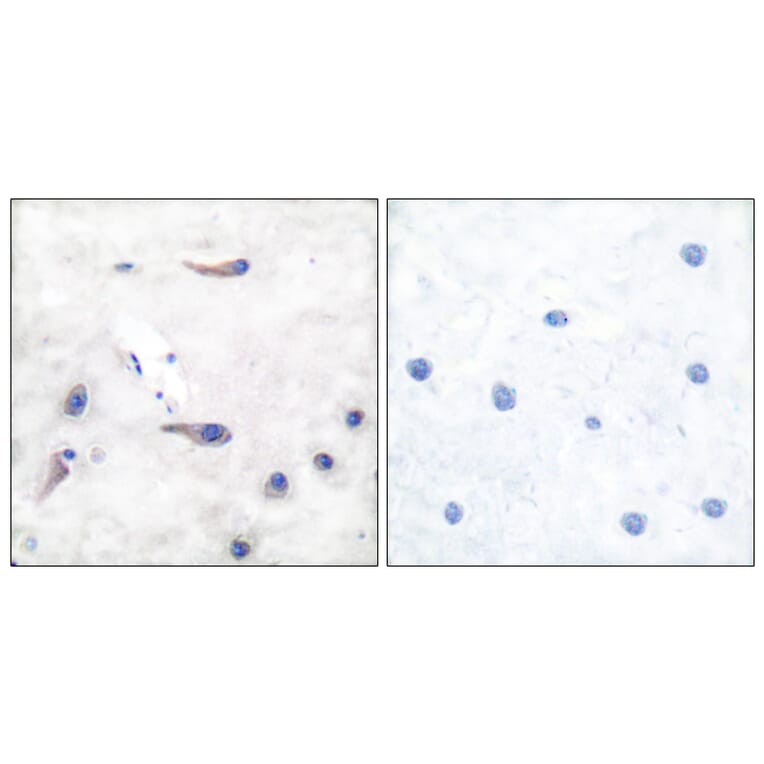 Immunohistochemistry - Anti-MARCKS Antibody (B7143) - Antibodies.com