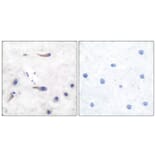 Immunohistochemistry - Anti-MARCKS Antibody (B7143) - Antibodies.com