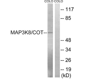 Western Blot - Anti-MAP3K8 Antibody (B8134) - Antibodies.com