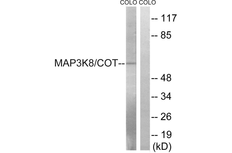 Western Blot - Anti-MAP3K8 Antibody (B8134) - Antibodies.com