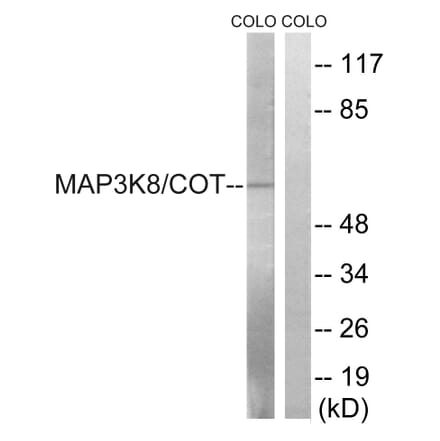 Western Blot - Anti-MAP3K8 Antibody (B8134) - Antibodies.com